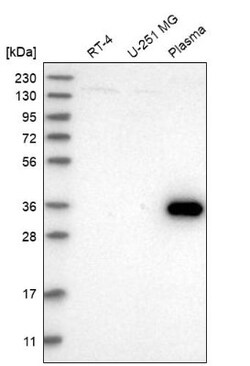 ZNF101 Antibody, Novus Biologicals:Antibodies:Primary Antibodies